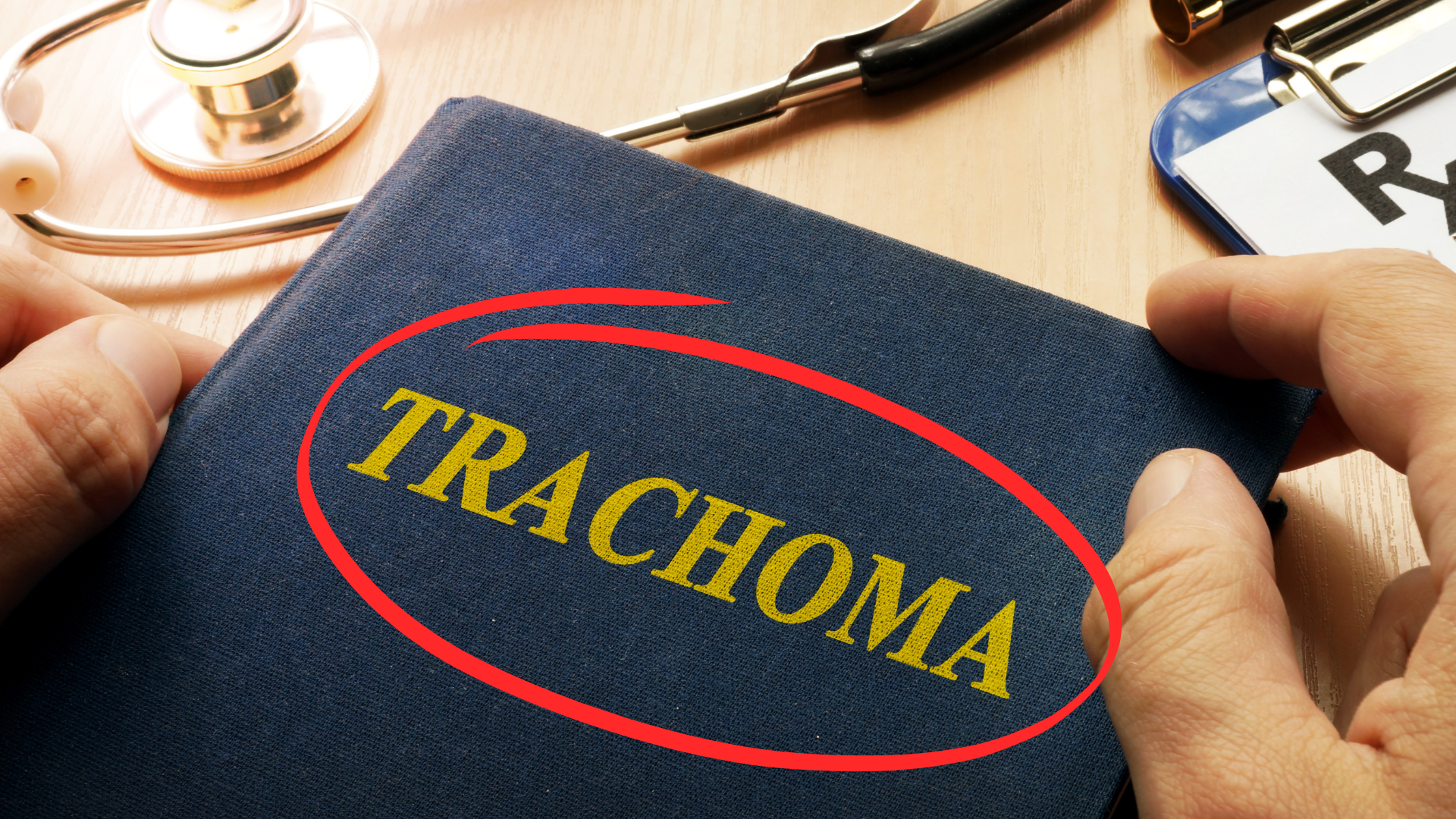 Trachoma - Dr Anthony Maloof, Sydney